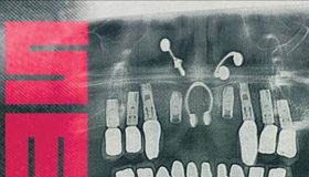 surgical meth machine cover 20160203