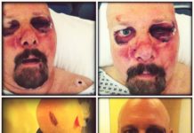 Pro-Pain – A brutálisan megvert Gary Meskil állapotától függ a budapesti koncert
